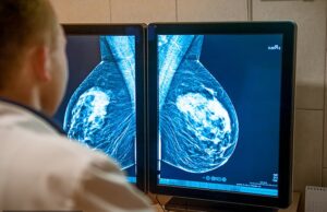 Milhares de mulheres para se beneficiar de uma pílula de um dia duas vezes para o câncer de mama mais comum que descreve os cientistas como ‘momentos marcantes’