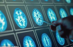 Especialistas alertam o vírus que todos alcançamos pode aumentar drasticamente o risco de demência jovem