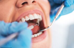 O NHS está enfrentando um déficit perigoso de tratamento odontológico ’12 ‘apenas para preencher uma das vagas’ apenas praticante de treinamento completo o suficiente ‘