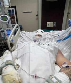 97517965-14631951-Robert_Thompson_suffered_third_degree_burns_to_his_body_and_spen-a-10_174525062614.jpeg