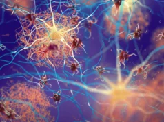 Cientistas descobrem interruptores cerebrais que eliminam placas de Alzheimer