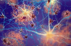 Cientistas descobrem interruptores cerebrais que eliminam placas de Alzheimer