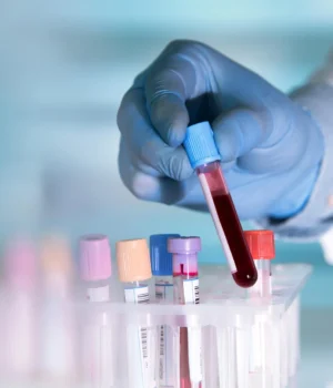 blood-test-tube-scientist.webp.webp
