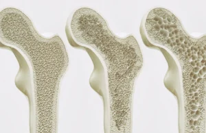 Esta descoberta pode beneficiar do exercício sem mover os ossos