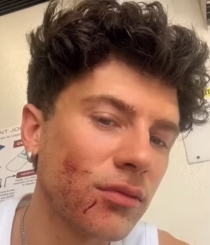 102825205-15173889-Berry_said_he_was_dragged_from_his_car_and_beaten_in_a_violent_r-a-65_17599616934.avif