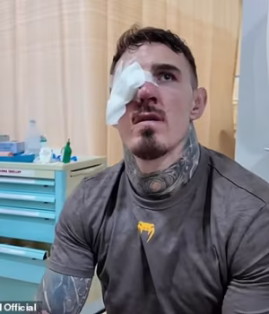 103354313-15231853-Tom_Aspinall_has_shown_off_the_aftermath_of_the_eye_injury_he_su-a-58_17615865959.avif