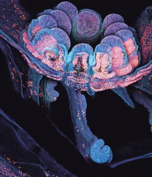 coral-polyp-cross-section.webp.webp
