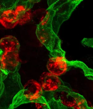 lung-repair-at2-and-at1-cells.webp.webp