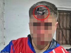 Na minha cabeça, garoto! Após briga entre os jogadores, as chaves do carro ficaram cravadas na testa do jogador de futebol