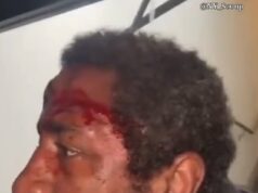 ‘Cuspidor em série’ que supostamente tinha como alvo mulheres brancas espancadas por gangues de rua