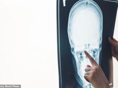 O atendimento imediato após um ferimento na cabeça pode reduzir drasticamente o risco de demência