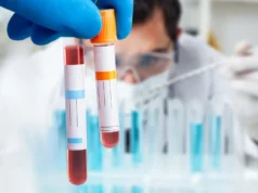 Exame de sangue inovador finalmente confirma síndrome de fadiga crônica