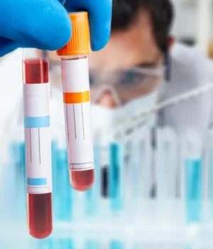 blood-test-scientist.webp.webp