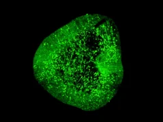 Um mapa cerebral inovador pode revolucionar o tratamento do Parkinson