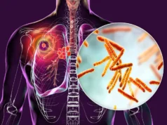 Este novo candidato a medicamento pode finalmente ultrapassar a tuberculose