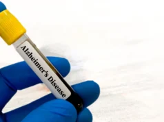 Os exames de sangue de Alzheimer podem ser confusos para pessoas com problemas renais