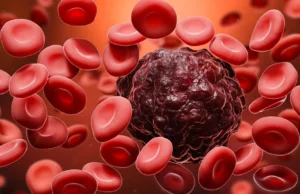 Este novo exame de sangue pode detectar o câncer antes que ele apareça em um exame