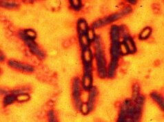 Brit compartilha experiências ‘muito assustadoras’ em remotas ilhas escocesas que você não encontrará no mapa