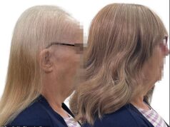 Juiz decide que a calvície feminina deve ser vista como uma ‘deficiência’ depois que um especialista em perucas leva o HMRC ao tribunal por causa de uma conta de impostos de £ 280 mil