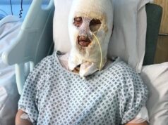 Pabgore, que despejou combustível em um aquecedor a gás que explodiu em uma bola de fogo, queimando gravemente dois primos, foi absolvido de GBH