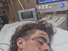 Apelo urgente da família de adolescente britânico gravemente ferido em acidente de viação na Tailândia para que volte para casa