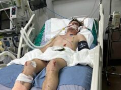 O britânico, de 21 anos, que estava em coma na Tailândia, ficou ferido em um acidente de scooter um dia antes de retornar ao Reino Unido, revelou sua devotada namorada, que promete manter uma vigília ao lado da cama até que ele volte para casa.