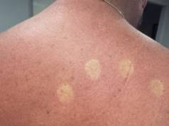 Por que esta única foto gerou indignação no Australia Post: ‘A pior que já vi’