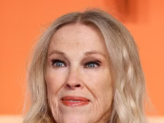 ‘Sintomas facilmente perdidos da condição de coagulação sanguínea que causou a morte de Catherine O’Hara’ revelados por um importante cardiologista, incluindo um estado mental geral e alterações nas unhas