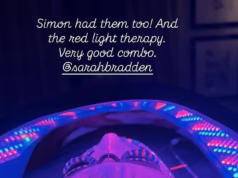 Simon Cowell, 66, desfruta de um tratamento extremo de £ 500 com Lauren Silverman, 48, enquanto eles relaxam com o rosto cheio de agulhas