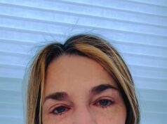 A chorosa Savannah Guthrie oferece uma recompensa de US$ 1 milhão por sua mãe sequestrada, Nancy Guthrie, 84, e admite pela primeira vez que pode estar morta.