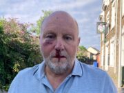 Motorista de van que quebrou a bochecha e a órbita ocular do avô depois de socá-lo por obedecer ao limite de velocidade de 32 km/h