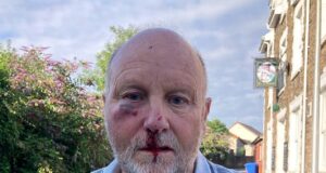 Motorista de van que quebrou a bochecha e a órbita ocular do avô depois de socá-lo por obedecer ao limite de velocidade de 32 km/h