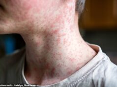 Alerta de saúde urgente, pois as autoridades admitem a propagação de um vírus altamente contagioso em Sydney