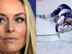 Lindsay Vonn mostra suas radiografias… e eca