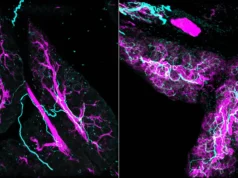 Cientistas descobrem que os nervos alimentam ativamente o câncer de pâncreas