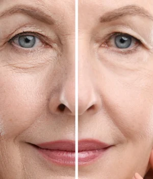 woman-anti-aging-beauty-treatment-face-close-up.webp.webp