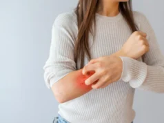 Cientistas descobriram a camada de açúcar escondida por trás da psoríase