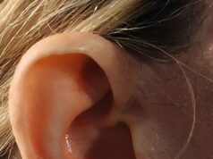 Como seus ouvidos sempre revelam sua idade real – então, você consegue adivinhar quais celebridades são traídas por seus lóbulos?