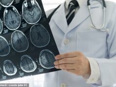 Pacientes com tumores cerebrais fatais não têm testes genéticos que salvam vidas, alertam instituições de caridade