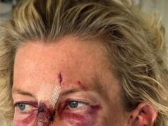 Como uma corajosa mãe australiana lutou contra um dentista famoso em desgraça que a prendeu e espancou depois de invadir sua unidade em Sydney