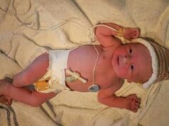 Pai dá à luz uma menina no hospital ‘com corda no pescoço’ depois que a parteira sai correndo de casa em pânico