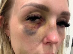 Mulher australiana violentamente atacada por seu ex-companheiro enquanto segurava seu bebê é forçada a tomar medidas dramáticas após ser libertada sob fiança