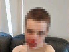 Imagens perturbadoras surgem depois que Aussie descobre seu filho machucado e ensanguentado em uma casa apoiada pelo NDIS na Austrália Ocidental
