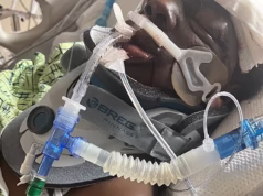 Mãe de dois filhos, 39 anos, sofreu lacerações internas por um motorista que atropelou e fugiu quando escorregou e caiu na estrada enquanto usava Crocs