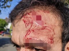 ‘Eu poderia ter morrido em um ataque racista’: a estrela de Zutone revela como sua cabeça foi cortada com um ‘pedaço de madeira’ depois que seu filho ‘disse aos jovens para pararem de fumar’