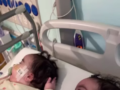 Jessie Nelson revelou que filhas gêmeas, de 9 meses, estão sendo tratadas no Great Ormond Street Hospital enquanto ela compartilhava fotos comoventes de suas talas nas pernas durante o tratamento contínuo para SMA