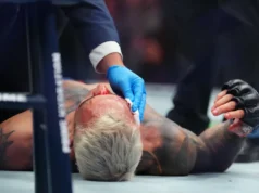 Megan Olivi: Perdedora do UFC 326 BMF enfrenta ‘muito tempo’ fora da disputa pelo título