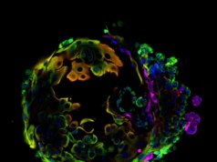 Estudo da UC Santa Cruz encontra ligação entre gravidez e redução do risco de câncer de mama – The Mercury News