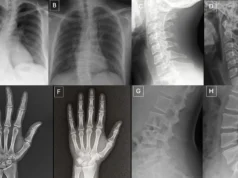 Radiografias falsas são tão reais que nem os médicos conseguem perceber a diferença