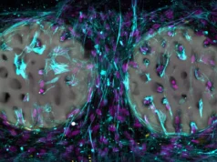 Implantes de hidrogel impressos a laser podem transformar o reparo ósseo